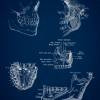 The TMJ - Patent-Style - Anatomie-Poster Bild 3