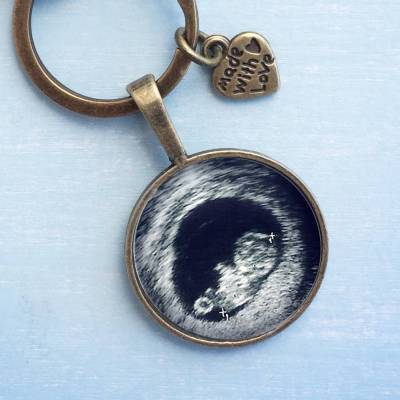 Personalisierter Schlüsselanhänger Ultraschallbild antikgold