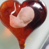 Kettenanhänger Herz mit Baby (Fötus) Inlay Bild 5
