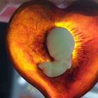 Kettenanhänger Herz mit Baby (Fötus) Inlay Bild 8