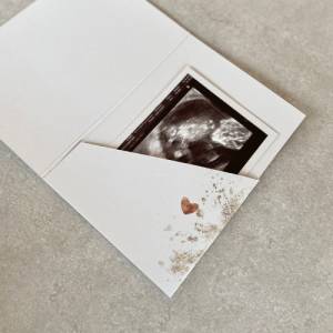 Erinnerungsmappe GRACE Ultraschallbilder Aufbewahrung Klappkarte mit Einschub individualisiert Bild 4